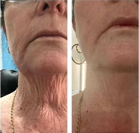 modere liquid biocell pure buy - Buy Modere Collagen - Where to buy Modere Products modere liquid biocell pure buy